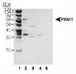 PINK1 Antibody in Western Blot (WB)