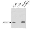 p14ARF Antibody in Western Blot (WB)