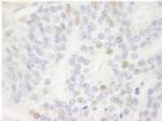 p14ARF Antibody in Immunohistochemistry (Paraffin) (IHC (P))