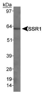 SSTR1 Antibody in Western Blot (WB)