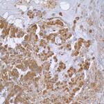 beta Actin Antibody in Immunohistochemistry (Paraffin) (IHC (P))