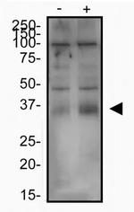 https://www.thermofisher.com/antibody/images/150/PA1-16893-SLC7A11-WB-1-20220707_163226.jpg?time=20220826