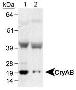 CRYAB Antibody in Western Blot (WB)