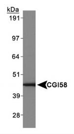 CGI58 Antibody in Western Blot (WB)