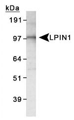 LPIN1 Antibody in Western Blot (WB)