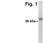 ADAMTS15 Antibody in Western Blot (WB)