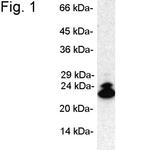 PSMB9 Antibody in Western Blot (WB)