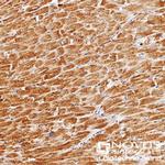 PHD3 Antibody in Immunohistochemistry (Paraffin) (IHC (P))