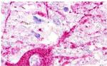 MAS1L Antibody in Immunohistochemistry (Paraffin) (IHC (P))