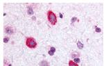 GALR3 Antibody in Immunohistochemistry (Paraffin) (IHC (P))