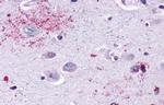 MAS1 Antibody in Immunohistochemistry (Paraffin) (IHC (P))