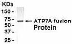 ATP7A Antibody in Western Blot (WB)