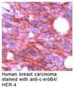 ErbB4 Antibody in Immunohistochemistry (IHC)