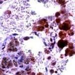 iNOS Antibody in Immunohistochemistry (IHC)