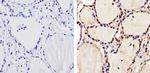 THRA Antibody in Immunohistochemistry (Paraffin) (IHC (P))