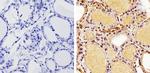 THRA Antibody in Immunohistochemistry (Paraffin) (IHC (P))