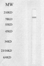 HSL Antibody in Western Blot (WB)