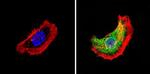 THRA Antibody in Immunocytochemistry (ICC/IF)