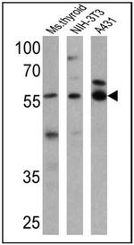 THRA Antibody in Western Blot (WB)