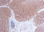 VEGF Receptor 1 Antibody in Immunohistochemistry (Paraffin) (IHC (P))