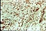 VEGF Receptor 1 Antibody in Immunohistochemistry (IHC)