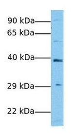 SCD Antibody in Western Blot (WB)