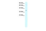 SCD Antibody in Western Blot (WB)