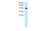 BARHL2 Antibody in Western Blot (WB)