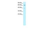 SNW1 Antibody in Western Blot (WB)