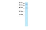 SOX18 Antibody in Western Blot (WB)