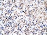 IRF8 Antibody in Immunohistochemistry (Paraffin) (IHC (P))