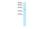 TAF7 Antibody in Western Blot (WB)