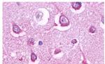 HTR5A Antibody in Immunohistochemistry (Paraffin) (IHC (P))