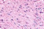 HTR5A Antibody in Immunohistochemistry (Paraffin) (IHC (P))