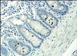 H3K9acS10ph Antibody in Immunohistochemistry (Paraffin) (IHC (P))