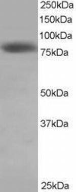 HEC1 Antibody in Western Blot (WB)