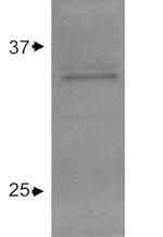 APOE Antibody in Western Blot (WB)