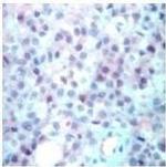 p14ARF Antibody in Immunohistochemistry (Paraffin) (IHC (P))