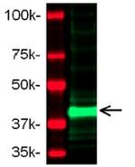 MMP1 Antibody in Western Blot (WB)