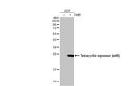 Tet Repressor Antibody in Western Blot (WB)