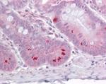 SETD7 Antibody in Immunohistochemistry (Paraffin) (IHC (P))