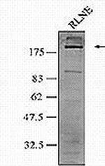 gp210 Antibody in Western Blot (WB)