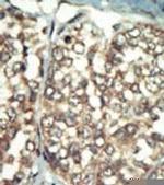 PI4K2B Antibody in Immunohistochemistry (Paraffin) (IHC (P))