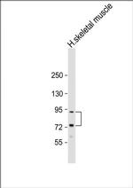 LTK Antibody in Western Blot (WB)