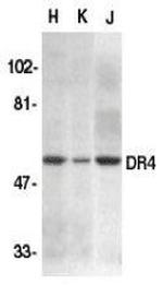 DR4 Antibody in Western Blot (WB)