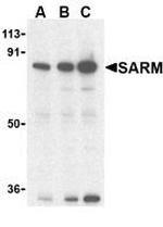 SARM Antibody in Western Blot (WB)