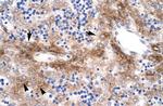 NR5A1 Antibody in Immunohistochemistry (Paraffin) (IHC (P))