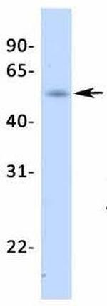 NR5A1 Antibody in Western Blot (WB)