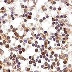 p19ARF Antibody in Immunohistochemistry (Paraffin) (IHC (P))