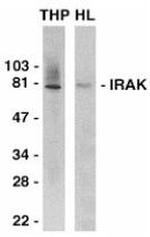 IRAK1 Antibody in Western Blot (WB)